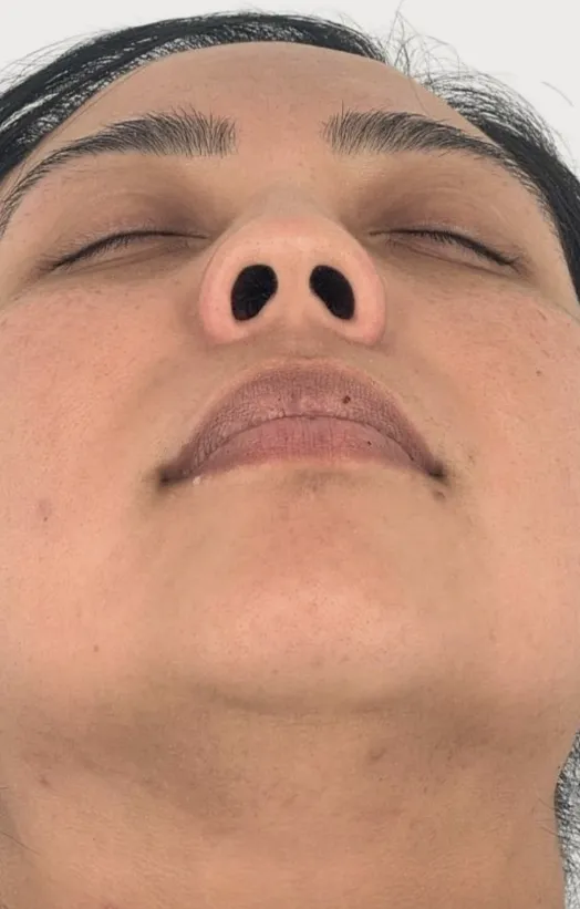 Nach der Behandlung